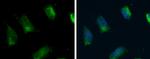 ACSL4 Antibody in Immunocytochemistry (ICC/IF)