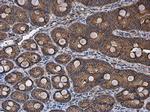 ACSL4 Antibody in Immunohistochemistry (Paraffin) (IHC (P))