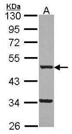 FNTB Antibody in Western Blot (WB)