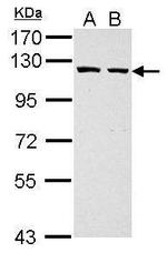 GART Antibody in Western Blot (WB)