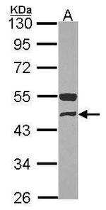 GCDH Antibody in Western Blot (WB)