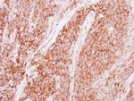 GNB1 Antibody in Immunohistochemistry (Paraffin) (IHC (P))