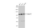 Golgin-97 Antibody in Western Blot (WB)