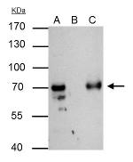 GTF2F1 Antibody in Immunoprecipitation (IP)