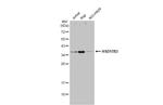 HSD17B3 Antibody in Western Blot (WB)