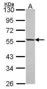 ICA1 Antibody in Western Blot (WB)