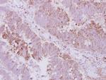 KIFC3 Antibody in Immunohistochemistry (Paraffin) (IHC (P))