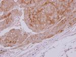 LDHC Antibody in Immunohistochemistry (Paraffin) (IHC (P))