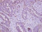 FADS1 Antibody in Immunohistochemistry (Paraffin) (IHC (P))