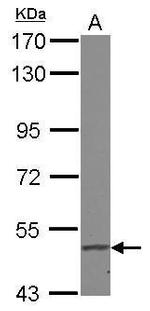 FADS1 Antibody in Western Blot (WB)