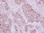 NBR1 Antibody in Immunohistochemistry (Paraffin) (IHC (P))