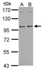 NBR1 Antibody in Western Blot (WB)