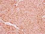 P2X5 Antibody in Immunohistochemistry (Paraffin) (IHC (P))