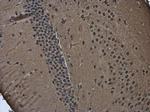 POU3F2 Antibody in Immunohistochemistry (Paraffin) (IHC (P))