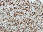 POU3F2 Antibody in Immunohistochemistry (Paraffin) (IHC (P))