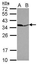 PPA1 Antibody in Western Blot (WB)