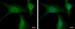 PPP2R3A Antibody in Immunocytochemistry (ICC/IF)