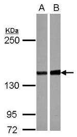 PPP2R3A Antibody in Western Blot (WB)