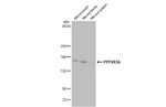 PPP2R3A Antibody in Western Blot (WB)