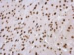 PSMC5 Antibody in Immunohistochemistry (Paraffin) (IHC (P))