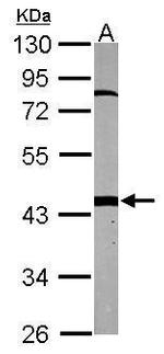 PSMC6 Antibody in Western Blot (WB)