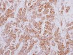 PSMD5 Antibody in Immunohistochemistry (Paraffin) (IHC (P))