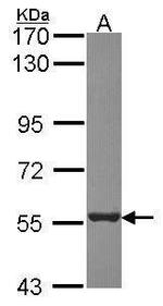 PSMD5 Antibody in Western Blot (WB)