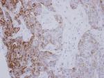 PYCR1 Antibody in Immunohistochemistry (Paraffin) (IHC (P))