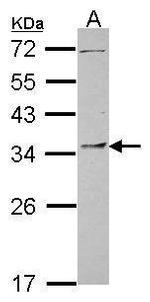 PYCR1 Antibody in Western Blot (WB)