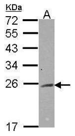 RAB2A Antibody in Western Blot (WB)