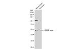 RORB Antibody in Western Blot (WB)