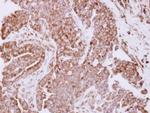 RPL7A Antibody in Immunohistochemistry (Paraffin) (IHC (P))