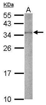 RPS2 Antibody in Western Blot (WB)