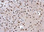 SATB1 Antibody in Immunohistochemistry (Paraffin) (IHC (P))