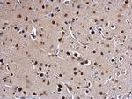 SATB1 Antibody in Immunohistochemistry (Paraffin) (IHC (P))