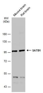 SATB1 Antibody in Western Blot (WB)