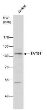 SATB1 Antibody in Western Blot (WB)