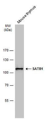 SATB1 Antibody in Western Blot (WB)