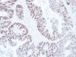 SATB1 Antibody in Immunohistochemistry (Paraffin) (IHC (P))