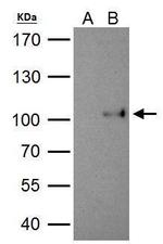 SATB1 Antibody in Immunoprecipitation (IP)