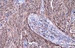 SERPINB3 Antibody in Immunohistochemistry (Paraffin) (IHC (P))