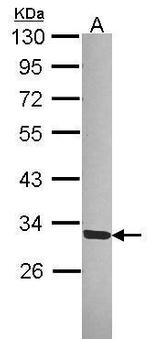 SGTA Antibody in Western Blot (WB)