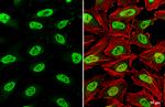 SMARCC1 Antibody in Immunocytochemistry (ICC/IF)