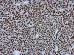 SMARCC1 Antibody in Immunohistochemistry (Paraffin) (IHC (P))