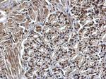 SMARCC1 Antibody in Immunohistochemistry (Paraffin) (IHC (P))