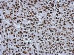 SMARCC1 Antibody in Immunohistochemistry (Paraffin) (IHC (P))