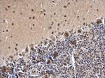 SMARCC1 Antibody in Immunohistochemistry (Paraffin) (IHC (P))