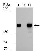 SMARCC1 Antibody in Immunoprecipitation (IP)