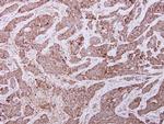 UQCRC2 Antibody in Immunohistochemistry (Paraffin) (IHC (P))