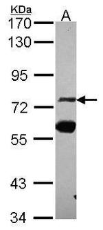 ZNF74 Antibody in Western Blot (WB)